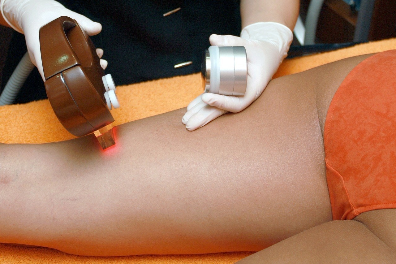 Best Hair Removal Process lasers three