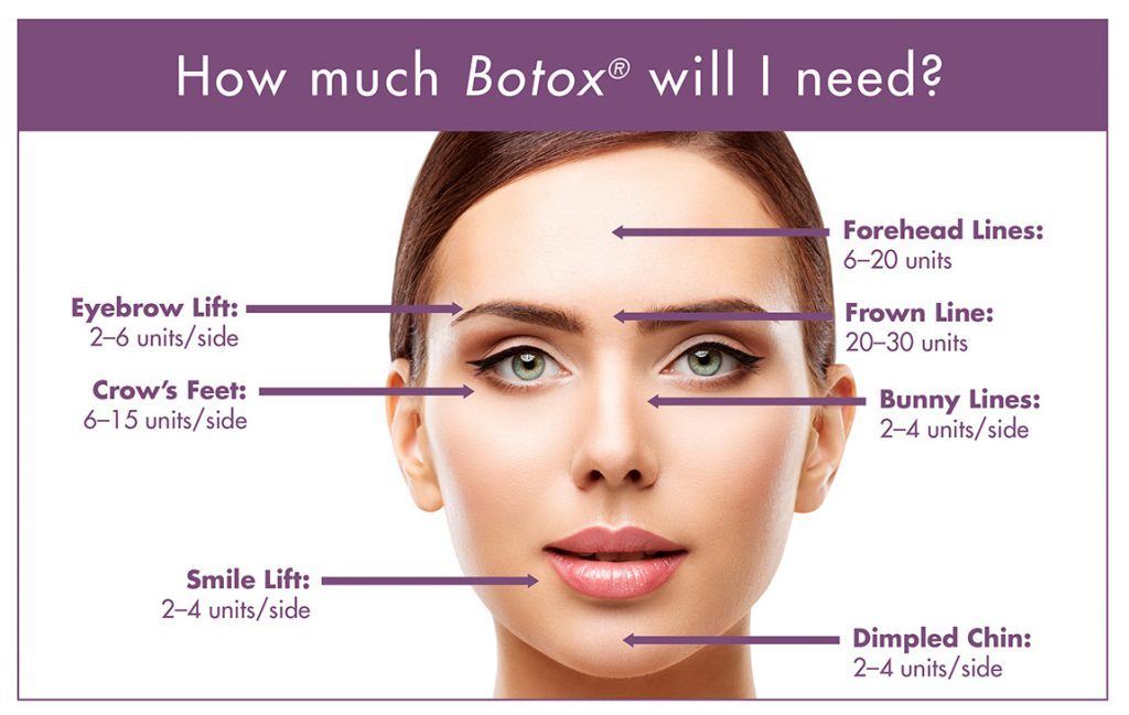 botox procedure injection units