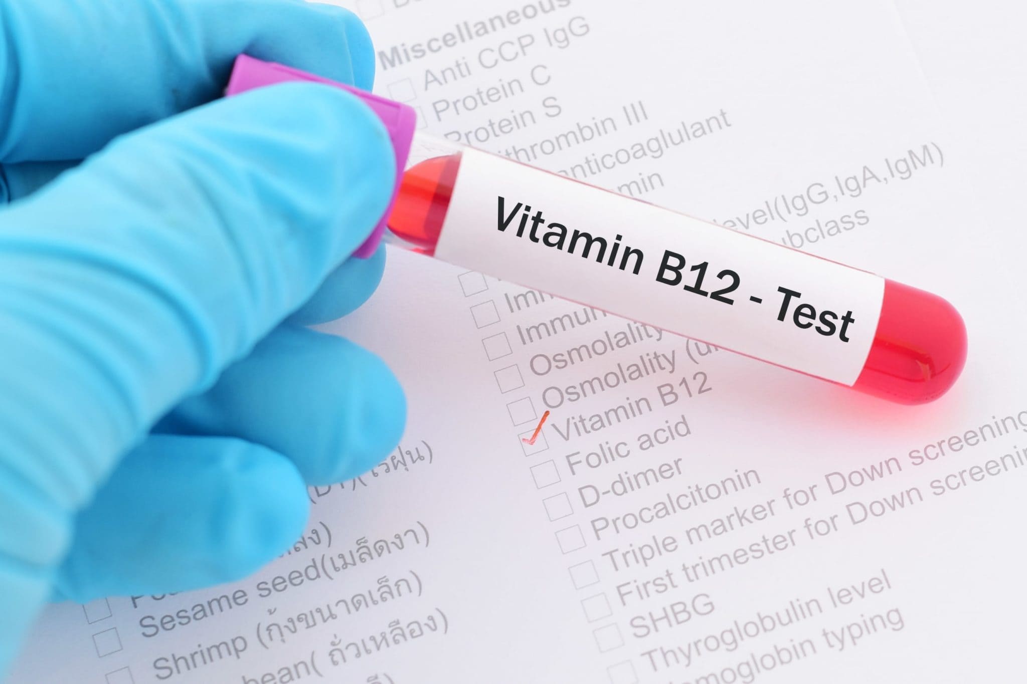 Know About Vitamin B12 Injections Safety & Benefits