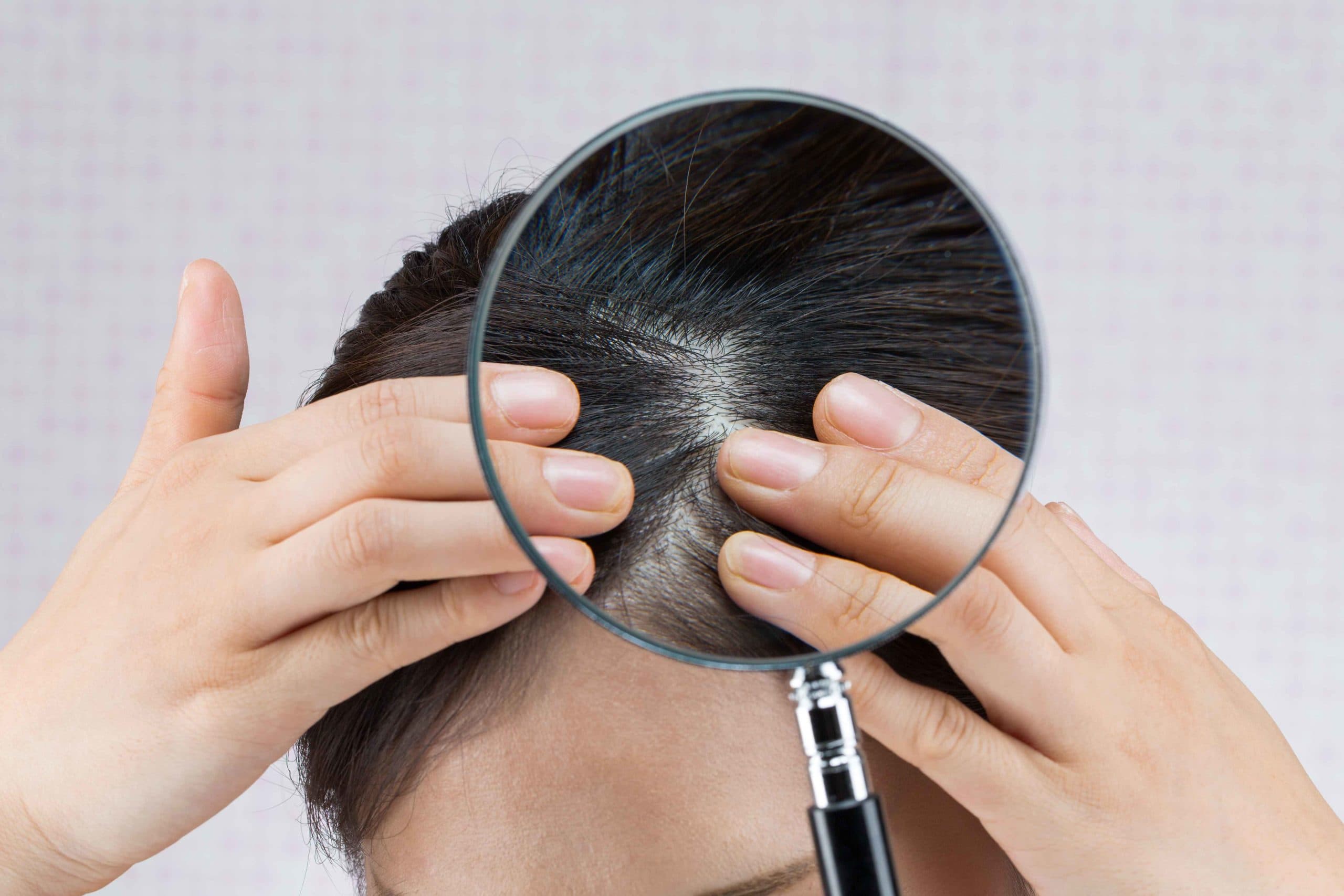 Hydrafacial™ Keravive™ 1 scalp hair growth scaled